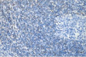 Immunohistochemistry was performed on paraffin-embedded human tonsillitis using bcl-2 antibody (ABIN7797719), 1:200). (Recombinant Bcl-2 antibody)