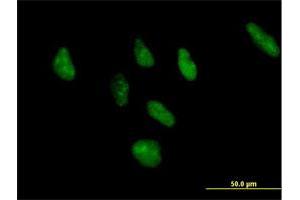 Immunofluorescence of purified MaxPab antibody to ZNF346 on HeLa cell. (ZNF346 antibody  (AA 1-294))