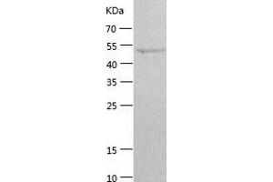 SIRT4 Protein (AA 1-314) (His-IF2DI Tag)