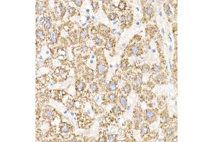 Immunohistochemistry of paraffin-embedded human liver using GN Rabbit mAb  at dilution of 1:25 (40x lens).