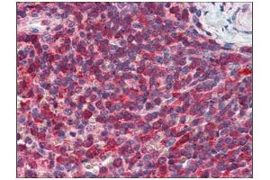 Immunohistochemistry (IHC) image for anti-Phosphatidylinositol-5-Phosphate 4-Kinase, Type II, alpha (PIP4K2A) (AA 304-366) antibody (ABIN782432) (PIP4K2A antibody  (AA 304-366))