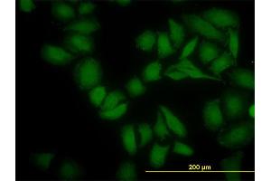 Immunofluorescence of monoclonal antibody to SGK2 on HeLa cell. (SGK2 antibody  (AA 293-367))