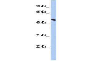 WB Suggested Anti-C9orf68 Antibody Titration: 0. (C9orf68 antibody  (Middle Region))