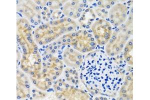 Immunohistochemistry of paraffin-embedded Mouse kidney using ANTXR2 Polyclonal Antibody at dilution of 1:100 (40x lens). (ANTXR2 antibody)