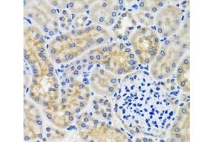 Immunohistochemistry of paraffin-embedded Mouse kidney using ANTXR2 Polyclonal Antibody at dilution of 1:100 (40x lens).