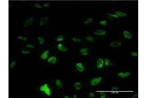 Immunofluorescence of monoclonal antibody to PUF60 on HeLa cell. (PUF60 antibody  (AA 1-516))