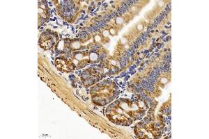 Immunohistochemistry of paraffin embedded mouse duodenum using TAF4 (ABIN7075827) at dilution of 1:450 (400x lens)