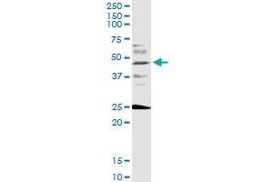 FOXF2 monoclonal antibody (M08), clone 3D11. (FOXF2 antibody  (AA 346-443))