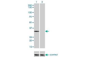 Western blot analysis of STK16 over-expressed 293 cell line, cotransfected with STK16 Validated Chimera RNAi (Lane 2) or non-transfected control (Lane 1). (STK16 antibody  (AA 1-305))