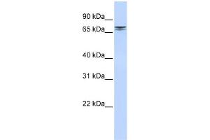WB Suggested Anti-NCAPH2 Antibody Titration: 0. (NCAPH2 antibody  (N-Term))