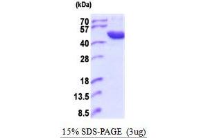 SDS-PAGE (SDS) image for Acid Phosphatase 6, Lysophosphatidic (ACP6) (AA 33-428) (Active) protein (His tag) (ABIN5854142)