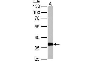 AKR1C1 antibody