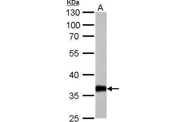 AKR1C1 antibody