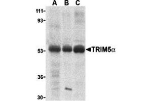 Western Blotting (WB) image for anti-Tripartite Motif Containing 5 (TRIM5) (Middle Region 1) antibody (ABIN1031194) (TRIM5 antibody  (Middle Region 1))