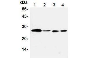 Western Blotting (WB) image for anti-B-Cell CLL/lymphoma 2 (BCL2) antibody (ABIN1105506) (Bcl-2 antibody)