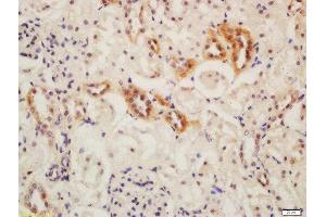 Formalin-fixed and paraffin embedded mouse kidney labeled with Rabbit Anti-ATG13 Polyclonal Antibody, Unconjugated  at 1:200 followed by conjugation to the secondary antibody and DAB staining