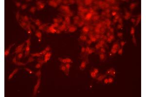 ABIN6277767 staining HEPG2 cells by ICC/IF. (NUMB antibody  (C-Term))
