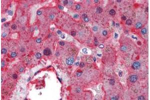 Human Liver (formalin-fixed, paraffin-embedded) stained with F2 antibody ABIN337281 at 5 ug/ml followed by biotinylated anti-mouse IgG secondary antibody ABIN481714, alkaline phosphatase-streptavidin and chromogen. (F2RL2 antibody)