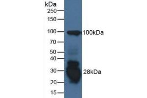 Detection of IFI30 in Human Raji Cells using Polyclonal Antibody to Interferon Gamma Inducible Protein 30 (IFI30) (IFI30 antibody  (AA 1-250))