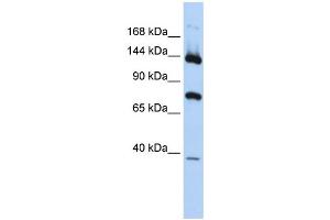 WB Suggested Anti-PLA2G4B Antibody Titration:  0. (PLA2G4B antibody  (N-Term))