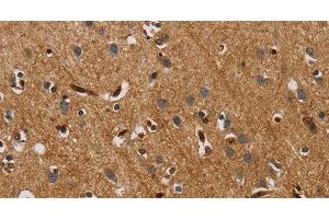Immunohistochemistry of paraffin-embedded Human brain tissue using IL18R1 Polyclonal Antibody at dilution 1:40 (IL18R1 antibody)