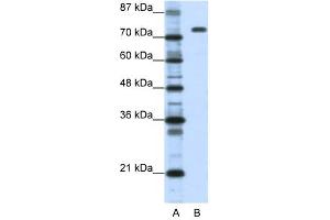 Nucleolin antibody used at 1.