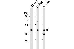 All lanes : Anti-P2ry4 Antibody (N-term) at 1:2000 dilution Lane 1: mouse heart lysates Lane 2: mouse liver lysates Lane 3: rat brain lysates Lysates/proteins at 20 μg per lane. (P2RY4 antibody  (N-Term))