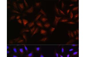 Immunofluorescence analysis of U-2 OS cells using BTRC Polyclonal Antibody at dilution of 1:100. (BTRC antibody)