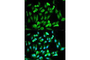 Immunofluorescence analysis of HeLa cells using ERG antibody (ABIN5970582). (ERG antibody)