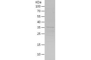 SIX2 Protein (AA 146-291) (His-IF2DI Tag)