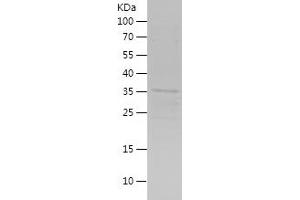 Western Blotting (WB) image for SIX Homeobox 2 (SIX2) (AA 146-291) protein (His-IF2DI Tag) (ABIN7125111) (SIX2 Protein (AA 146-291) (His-IF2DI Tag))