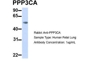 Host:  Rabbit  Target Name:  PPP3CA  Sample Type:  Human Fetal Lung  Antibody Dilution:  1. (PPP3CA antibody  (Middle Region))