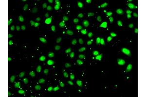 Immunofluorescence analysis of HeLa cells using NUDT2 antibody.