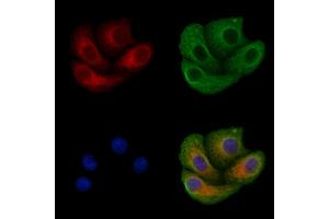 ABIN6257649 and ABIN6275602 staining Hela cells by IF/ICC. (Sorting Nexin 4 antibody  (Internal Region))