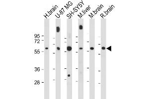 All lanes : Anti-INA Antibody (Center) at 1:1000-2000 dilution Lane 1: Human brain tissue lysate Lane 2: U-87 MG whole cell lysate Lane 3: SH-SY5Y whole cell lysate Lane 4: Mouse liver tissue lysate Lane 5: Mouse brain tissue lysate Lane 6: Rat brain tissue lysate Lysates/proteins at 20 μg per lane. (INA antibody  (AA 290-319))