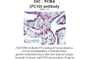Image no. 1 for anti-Proliferating Cell Nuclear Antigen (PCNA) antibody (ABIN1724017) (PCNA antibody)