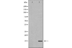 Western blot analysis of extracts of Mouse brain tissue lysate, using KISS1antibody.