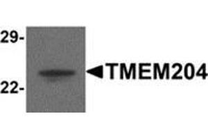 TMEM204 Antikörper  (C-Term)