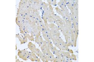 Immunohistochemistry of paraffin-embedded rat heart using GPLD1 antibody (ABIN5973975) at dilution of 1/100 (40x lens). (GPLD1 antibody)