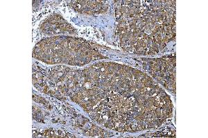 IHC analysis of FRY using anti-FRY antibody (ABIN7599716). (FRY antibody  (AA 11-3013))