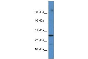 FAM36A antibody used at 1 ug/ml to detect target protein. (FAM36A antibody  (Middle Region))