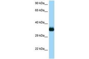 Image no. 1 for anti-CDC42 Effector Protein (Rho GTPase Binding) 4 (CDC42EP4) (AA 150-199) antibody (ABIN6748281) (CDC42EP4 antibody  (AA 150-199))