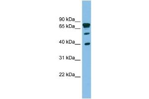 WB Suggested Anti-LETMD1 Antibody Titration: 0. (LETMD1 antibody  (Middle Region))