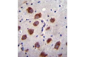 BR1B Antibody (Center) (ABIN655973 and ABIN2845358) immunohistochemistry analysis in formalin fixed and paraffin embedded human brain tissue followed by peroxidase conjugation of the secondary antibody and DAB staining.