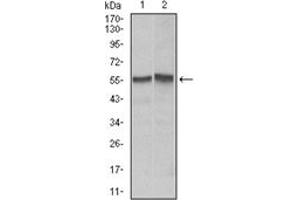 Western Blotting (WB) image for anti-TNF Receptor Superfamily, Member 6 (FAS) antibody (ABIN1106617) (FAS antibody)