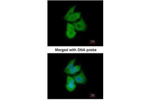 Immunofluorescence (IF) image for anti-Phosphofructokinase, Liver (PFKL) (Center) antibody (ABIN2856164)