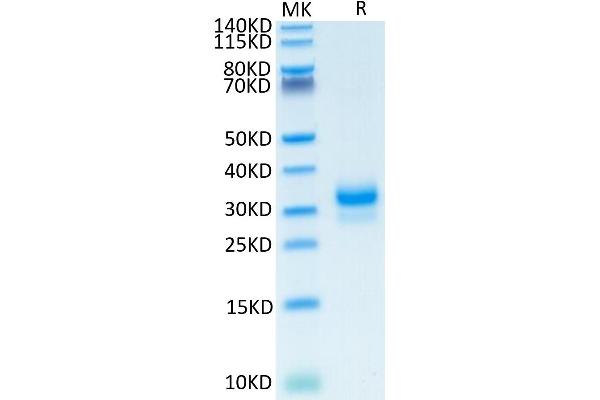 TFPI2 Protein (AA 23-213) (His tag)