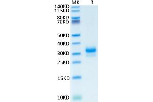 Human TFPI-2 on Tris-Bis PAGE under reduced condition.