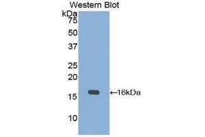 Western Blotting (WB) image for anti-Keratin 15 (KRT15) (AA 274-399) antibody (ABIN5662045) (KRT15 antibody  (AA 274-399))