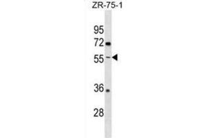 Western Blotting (WB) image for anti-Ectonucleoside Triphosphate diphosphohydrolase 5 (ENTPD5) antibody (ABIN3000843) (ENTPD5 antibody)